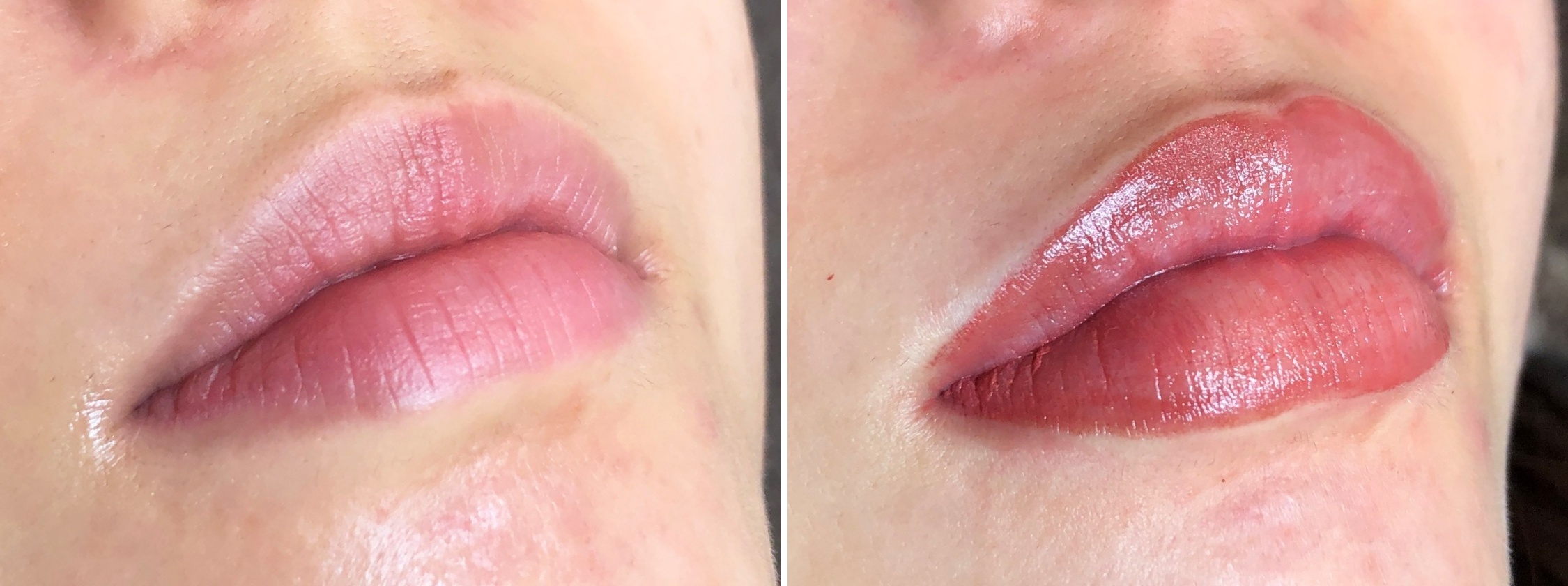 Tacメディカルアートメイク 眉 アイライン リップなら大阪taクリニック ダウンタイム 費用 効果 大阪taクリニック 大阪 心斎橋の美容整形 美容外科