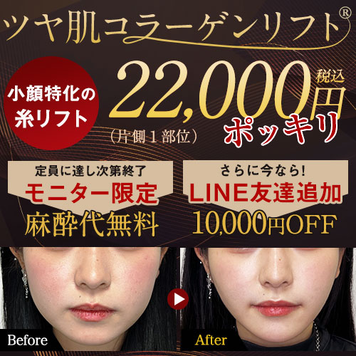 TAC式 ツヤ肌コラーゲンリフト®