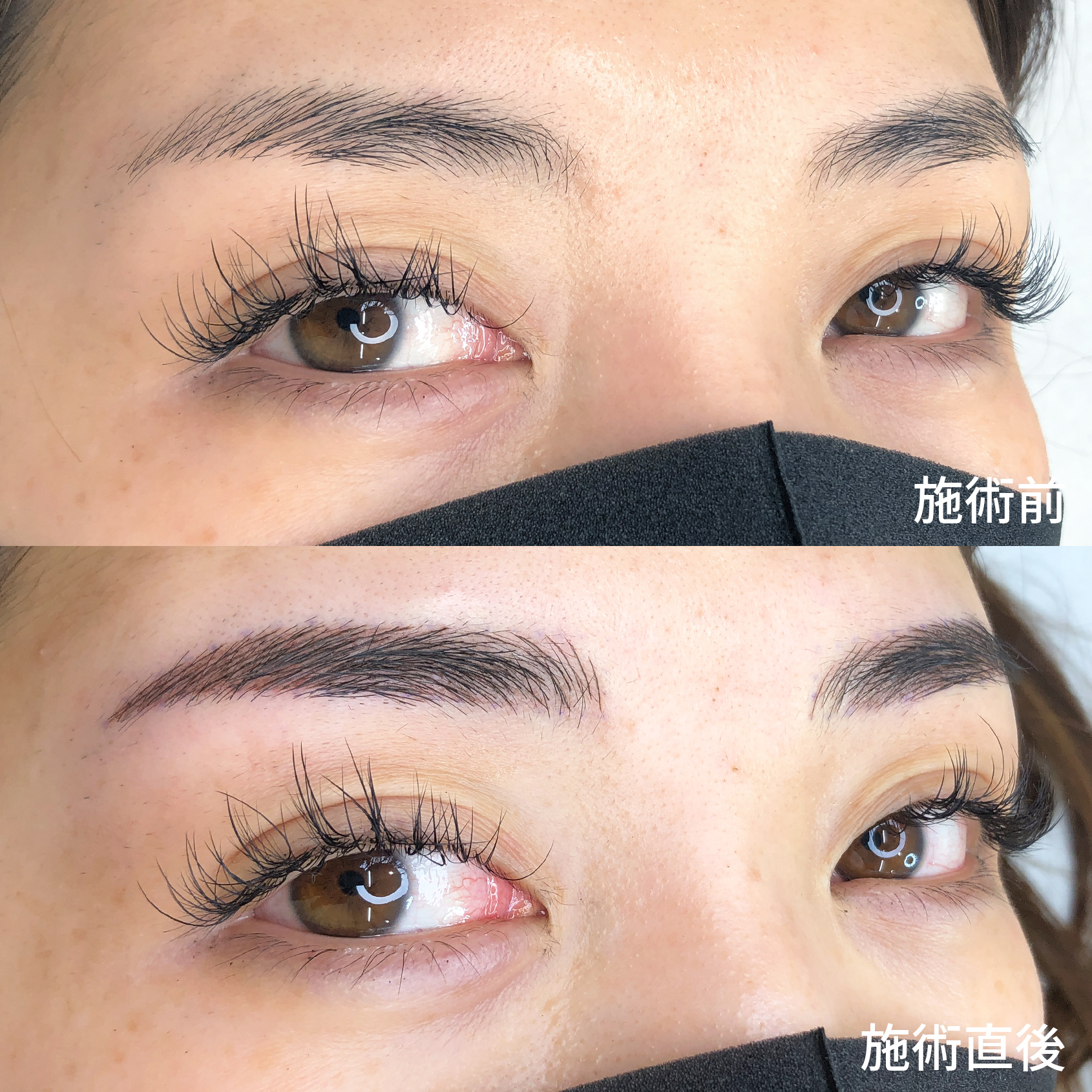 症例写真 ビフォーアフター ダウンタイム 副作用 眉アートメイク 4dデザインで まるで自眉毛が増えたかのような自然さ Taクリニックグループ 美容整形 美容外科 全国展開中 症例写真 ビフォーアフター ダウンタイム 副作用 眉アートメイク 4dデザインで まるで自眉毛が増えたかのような自然さ Taクリニックグループ 美容整形 美容外科 全国展開中