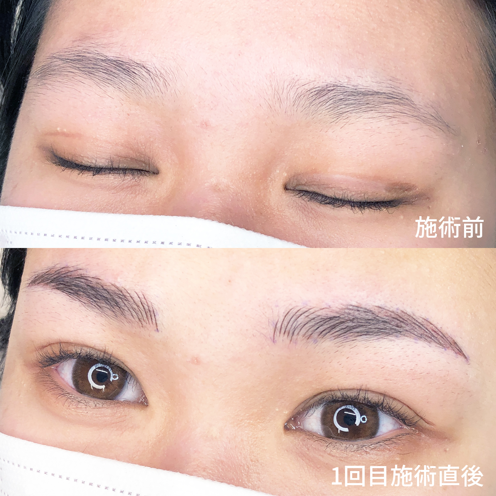 症例写真 ビフォーアフター ダウンタイム 副作用 眉アートメイク 4dデザインで一気に垢抜け眉 Taクリニックグループ 美容整形 美容外科 全国展開中 症例写真 ビフォーアフター ダウンタイム 副作用 眉アートメイク 4dデザインで一気に垢抜け眉 Taクリニックグループ 美容整形 美容外科 全国展開中