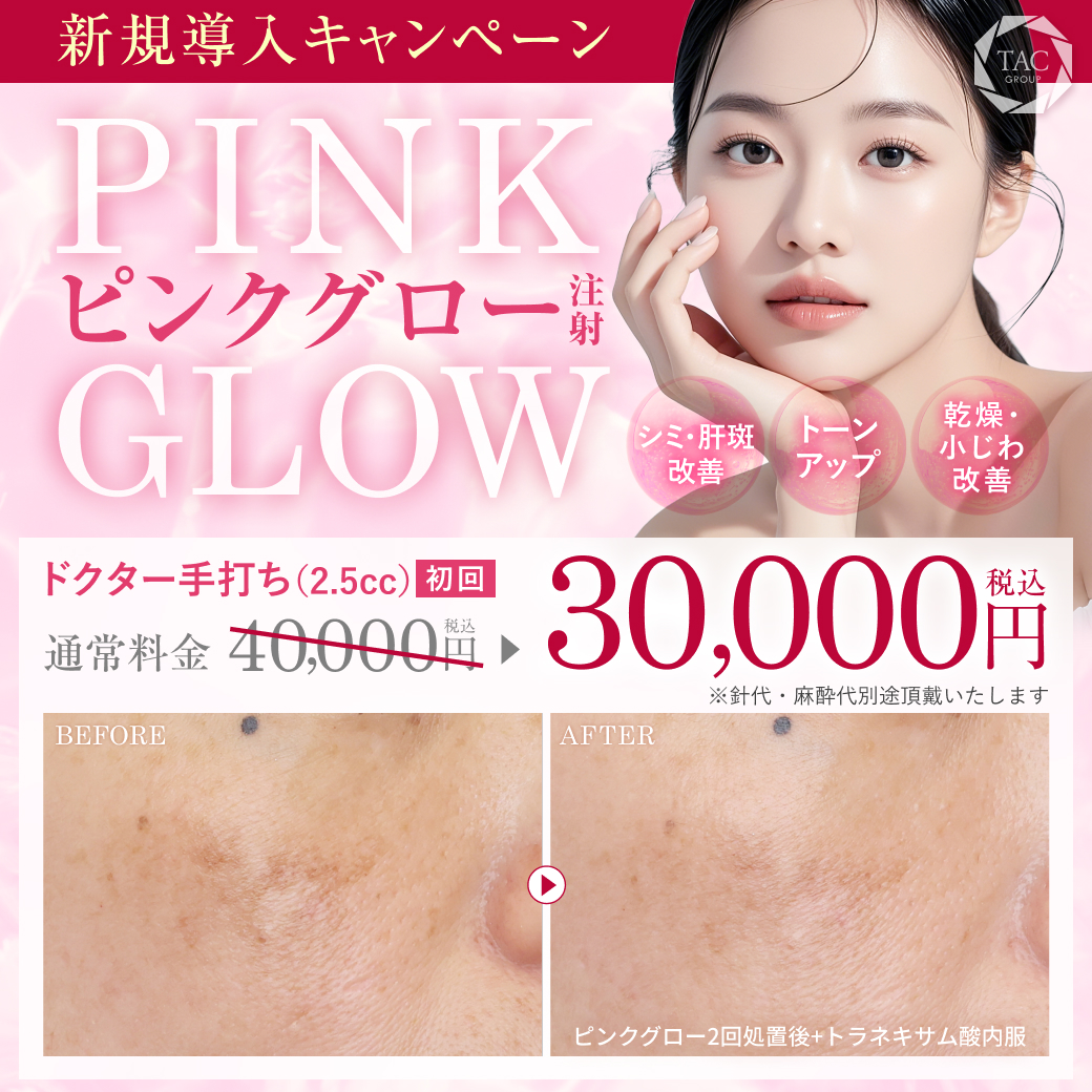 ピンクグロー_キャンペーン価格